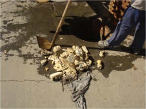 gordura_calcificada